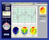 AEP Analysis