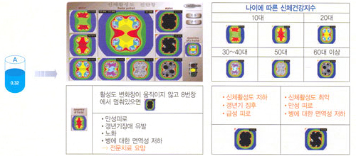 신체의 활성도 평가