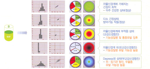 자율신경계 균형 분석